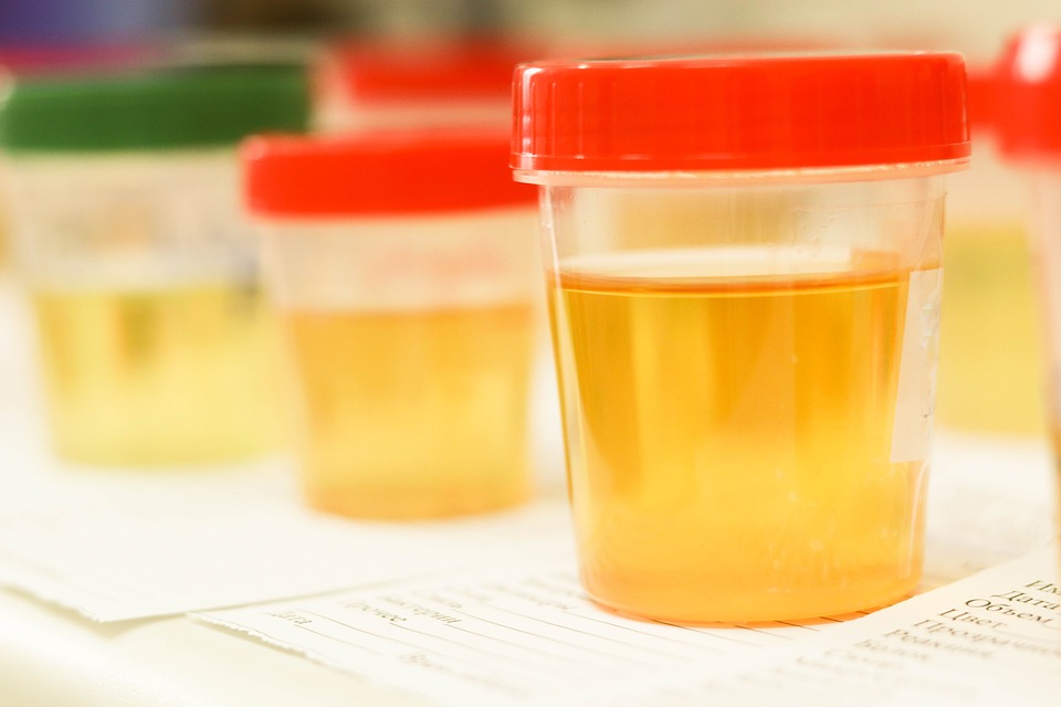 Qualities of a Good Synthetic Urine Brand for Drug Testing