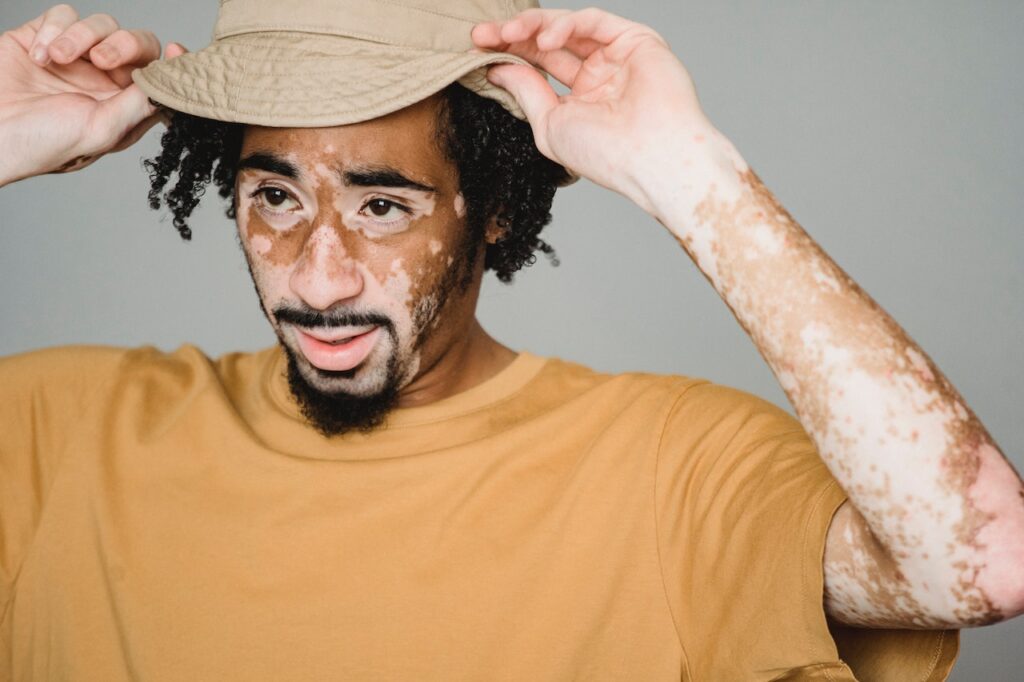 A Comprehensive Guide to Safe and Effective Pigmentation Removal Methods