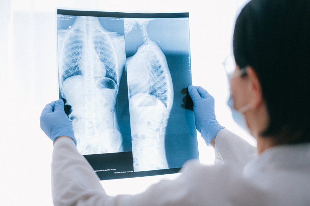 Things to Expect During a Spinal MRI Scan for a Safer and Accurate Diagnosis